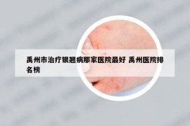 禹州市治疗银翘病那家医院最好 禹州医院排名榜