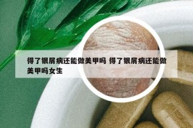 得了银屑病还能做美甲吗 得了银屑病还能做美甲吗女生