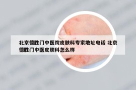 北京德胜门中医院皮肤科专家地址电话 北京德胜门中医皮肤科怎么样