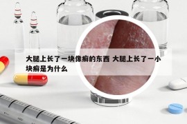 大腿上长了一块像癣的东西 大腿上长了一小块癣是为什么