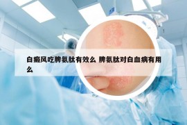 白癜风吃脾氨肽有效么 脾氨肽对白血病有用么