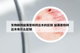 生物制剂益赛普和阿达木的区别 益赛普和阿达木有什么区别