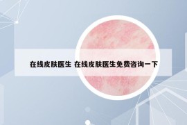 在线皮肤医生 在线皮肤医生免费咨询一下