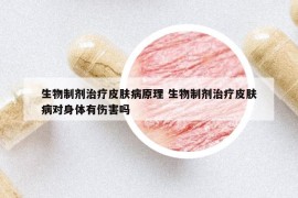 生物制剂治疗皮肤病原理 生物制剂治疗皮肤病对身体有伤害吗