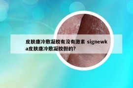 皮肤康冷敷凝胶有没有激素 signewka皮肤康冷敷凝胶假的?