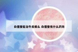 白僵蚕能治牛皮癣么 白僵蚕有什么药效