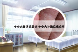 十全大补汤银屑病 十全大补汤临床应用