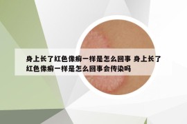 身上长了红色像癣一样是怎么回事 身上长了红色像癣一样是怎么回事会传染吗