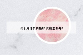 长廯用什么药最好 长癍怎么办?