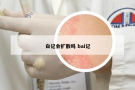 白记会扩散吗 bai记