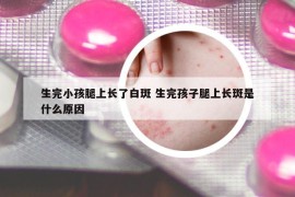 生完小孩腿上长了白斑 生完孩子腿上长斑是什么原因