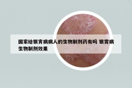 国家给银宵病病人的生物制剂药有吗 银霄病生物制剂效果