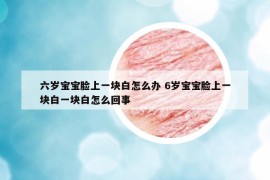 六岁宝宝脸上一块白怎么办 6岁宝宝脸上一块白一块白怎么回事