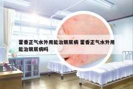 藿香正气水外用能治银屑病 藿香正气水外用能治银屑病吗