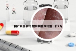 国产银屑病针 银屑病特效针剂一针2万