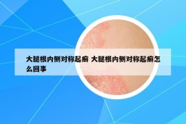 大腿根内侧对称起癣 大腿根内侧对称起癣怎么回事