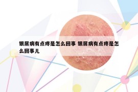 银屑病有点疼是怎么回事 银屑病有点疼是怎么回事儿