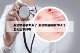 点滴银屑病太多了 点滴银屑病都20天了 怎么还不好呢