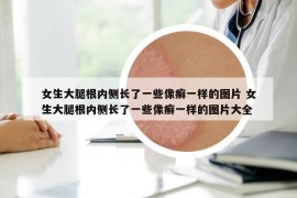 女生大腿根内侧长了一些像癣一样的图片 女生大腿根内侧长了一些像癣一样的图片大全