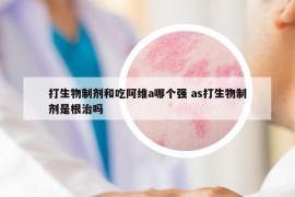 打生物制剂和吃阿维a哪个强 as打生物制剂是根治吗