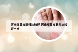 河南哪里皮肤科比较好 河南哪里皮肤科比较好一点