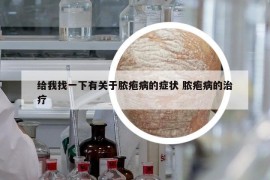 给我找一下有关于脓疱病的症状 脓疱病的治疗