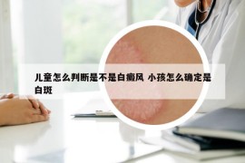 儿童怎么判断是不是白癜风 小孩怎么确定是白斑