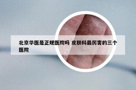 北京华医是正规医院吗 皮肤科最厉害的三个医院