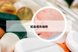 蛇盘疮长啥样