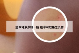 适今可多少钱一瓶 适今可效果怎么样