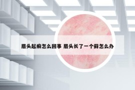 眉头起癣怎么回事 眉头长了一个藓怎么办