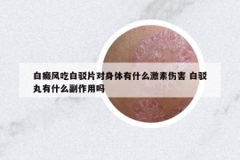 白癜风吃白驳片对身体有什么激素伤害 白驳丸有什么副作用吗