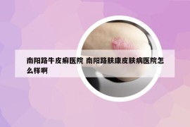 南阳路牛皮癣医院 南阳路肤康皮肤病医院怎么样啊