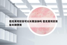 他克莫司软膏可以长期涂抹吗 他克莫司软膏能长期使用