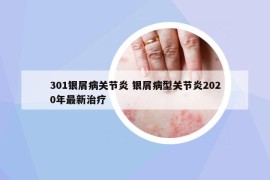 301银屑病关节炎 银屑病型关节炎2020年最新治疗