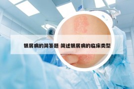 银屑病的简答题 简述银屑病的临床类型