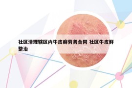 社区清理辖区内牛皮癣劳务合同 社区牛皮鲜整治