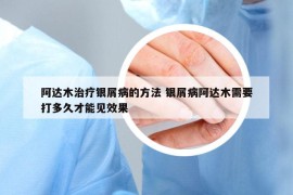 阿达木治疗银屑病的方法 银屑病阿达木需要打多久才能见效果