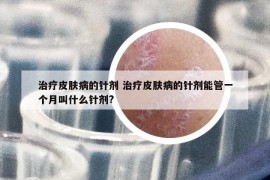 治疗皮肤病的针剂 治疗皮肤病的针剂能管一个月叫什么针剂?