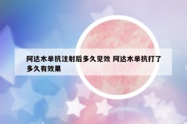 阿达木单抗注射后多久见效 阿达木单抗打了多久有效果