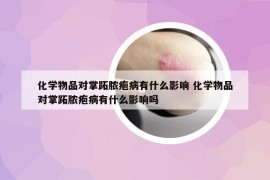 化学物品对掌跖脓疱病有什么影响 化学物品对掌跖脓疱病有什么影响吗