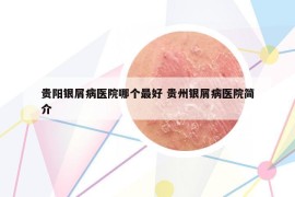 贵阳银屑病医院哪个最好 贵州银屑病医院简介