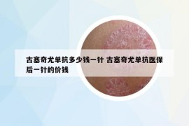 古塞奇尤单抗多少钱一针 古塞奇尤单抗医保后一针的价钱