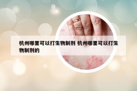 杭州哪里可以打生物制剂 杭州哪里可以打生物制剂的