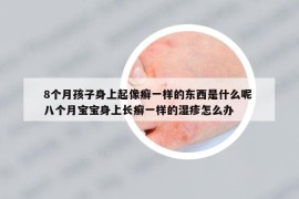 8个月孩子身上起像癣一样的东西是什么呢 八个月宝宝身上长癣一样的湿疹怎么办