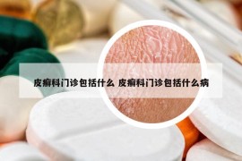 皮癣科门诊包括什么 皮癣科门诊包括什么病