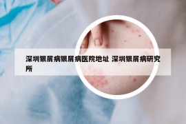 深圳银屑病银屑病医院地址 深圳银屑病研究所