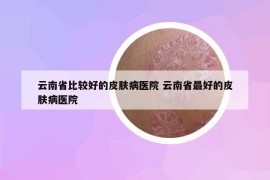 云南省比较好的皮肤病医院 云南省最好的皮肤病医院