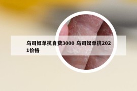 乌司奴单抗自费3000 乌司奴单抗2021价格