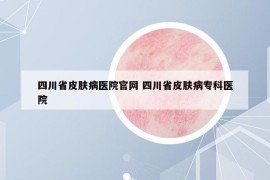 四川省皮肤病医院官网 四川省皮肤病专科医院